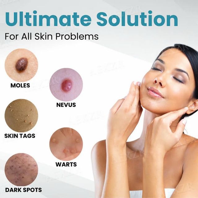 [⚡️BEST DEAL TODAY]🔥Non-Invasive Mole and Wart Removal Laser Pen