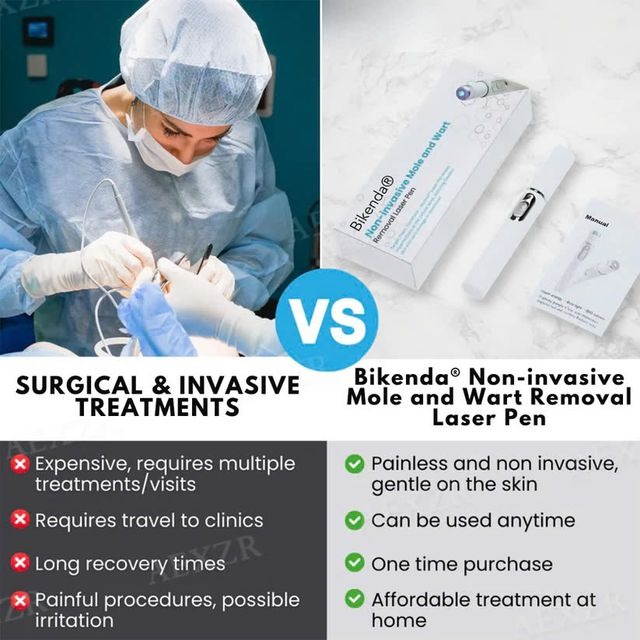 [⚡️BEST DEAL TODAY]🔥Non-Invasive Mole and Wart Removal Laser Pen